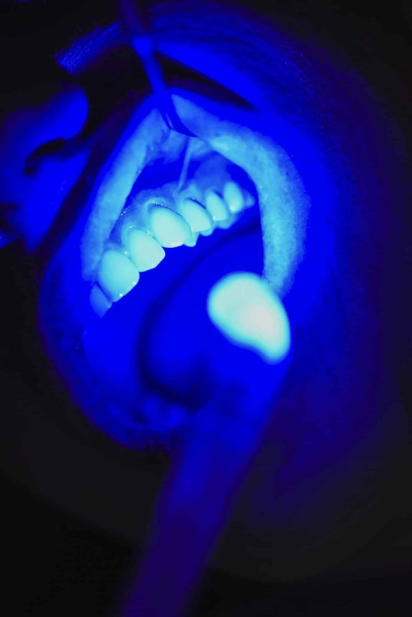 Quelles sont les dernières technologies dentaires utilisées à la Clinique Dentaire Maizerets ?